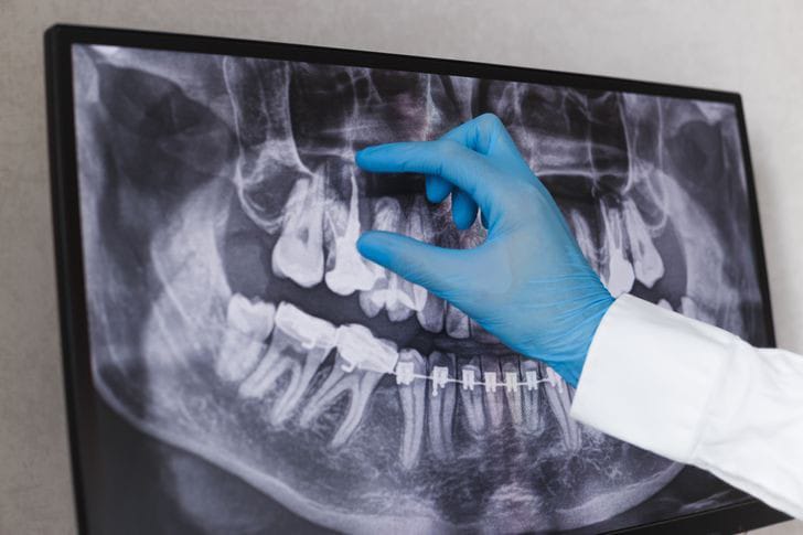 Digital X-Ray